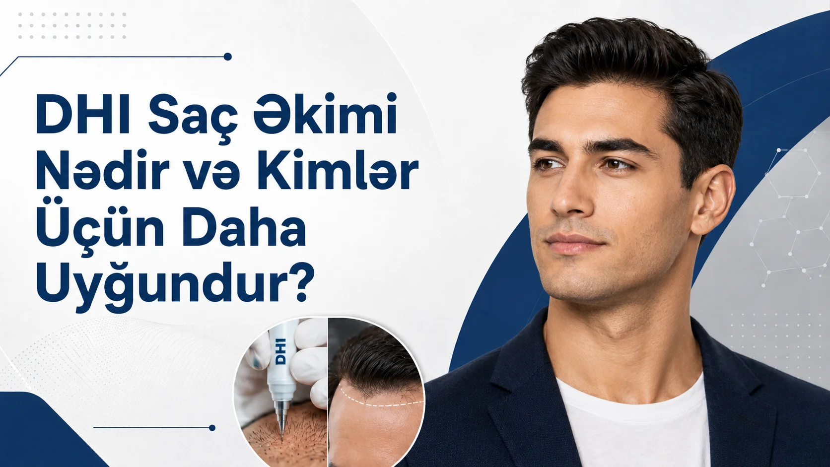 dhi saç əkimi nədir