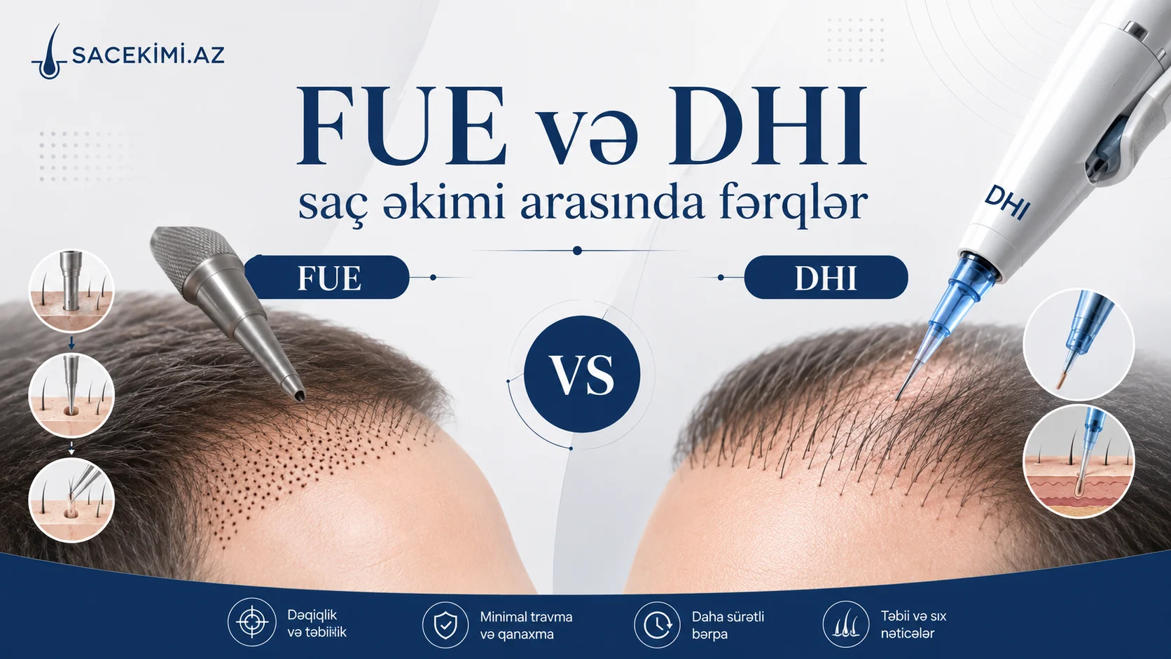 FUE ve DHI sac ekimi arasinda ferqler