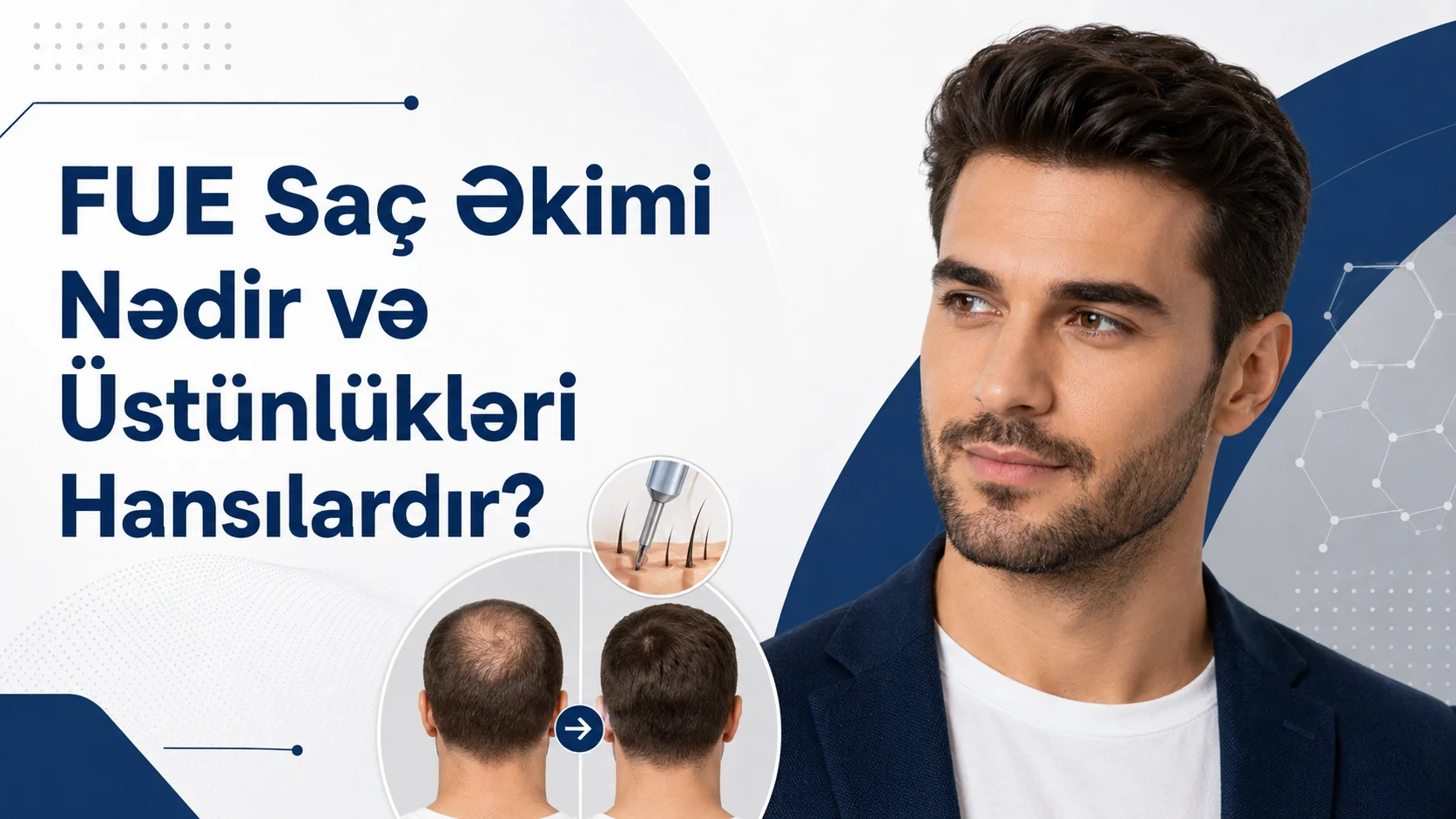 FUE Sac Ekimi Nedir?