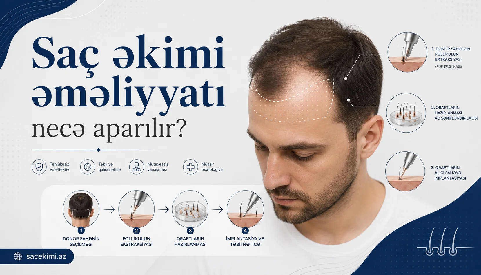 Sac ekimi emeliyyati nece aparilir?