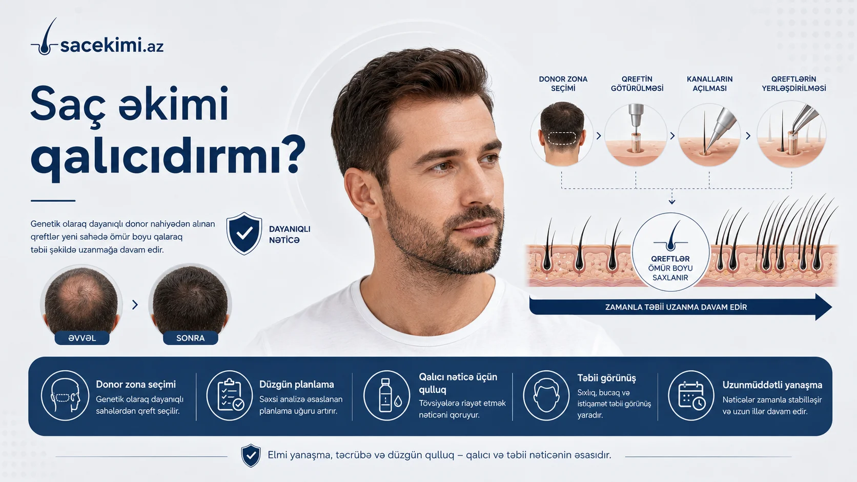 Sac ekimi qalicidirmi?