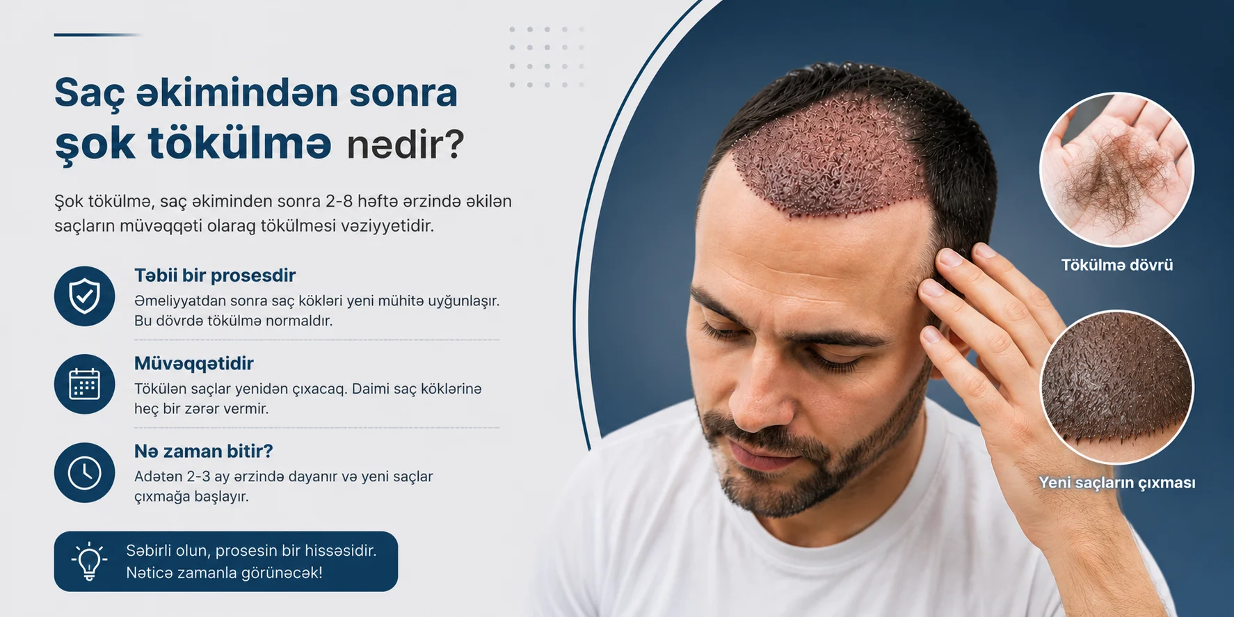 Sac ekiminden sonra sok tokulme nedir?