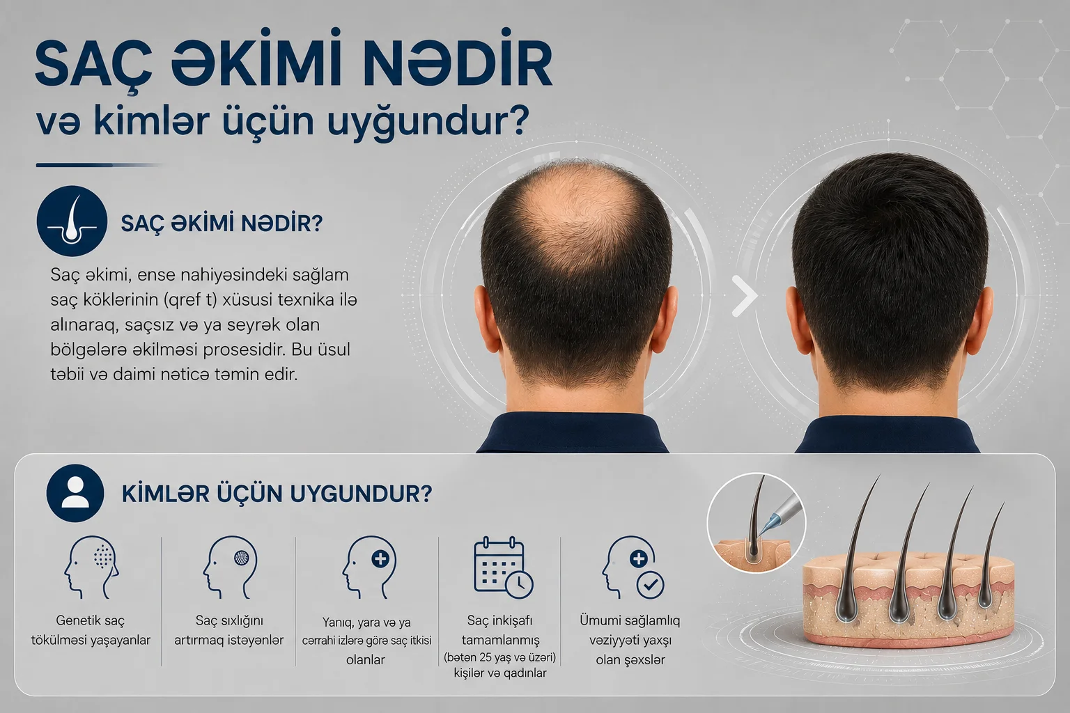 Sac Ekimi Nedir ve Kimler Ucun Uygundur?
